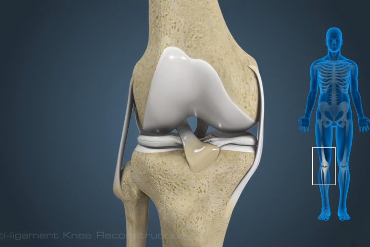 Knee Surgery Bangalore
