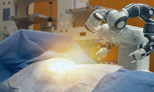 Benefits Of Robotic Knee Replacement Surgery
