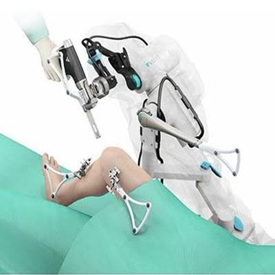 Knee Replacement Surgery: A Modern Approach with Computer-Assisted Technology