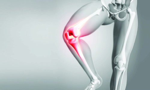Knee Replacement Surgery in Bangalore: Myths vs Facts