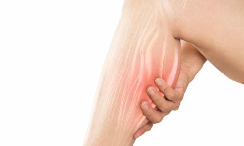 Muscle cramps: What You Should Know?