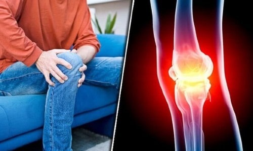 Seven symptoms of arthritis in the knee