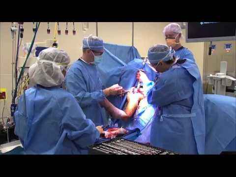 Shoulder Replacement Surgeon in Bangalore