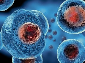 Stem cell therapy