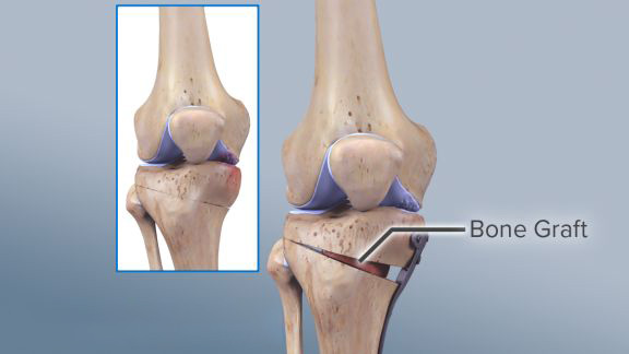 Knee & Shoulder Surgery
